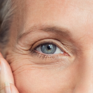 Blefaroplastyka